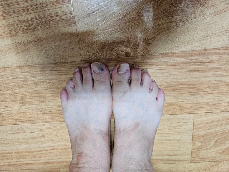 구매자가 올린 리뷰 사진